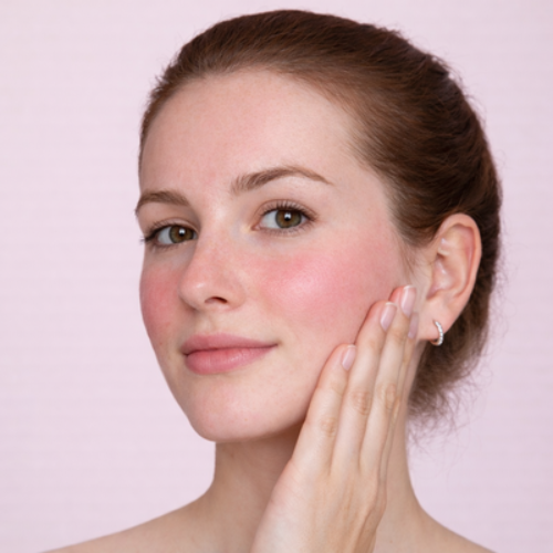 woman with sensitive skin touching her blushed cheeks