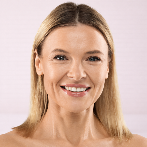 smiling woman in her 40's with fine lines 