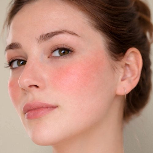 woman with sensitive skin touching her blushed cheeks